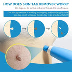Skin Tag Removal Kit with Dual Heads and 40 Silicone Bands, Cleansing Wipes All Vera Mart