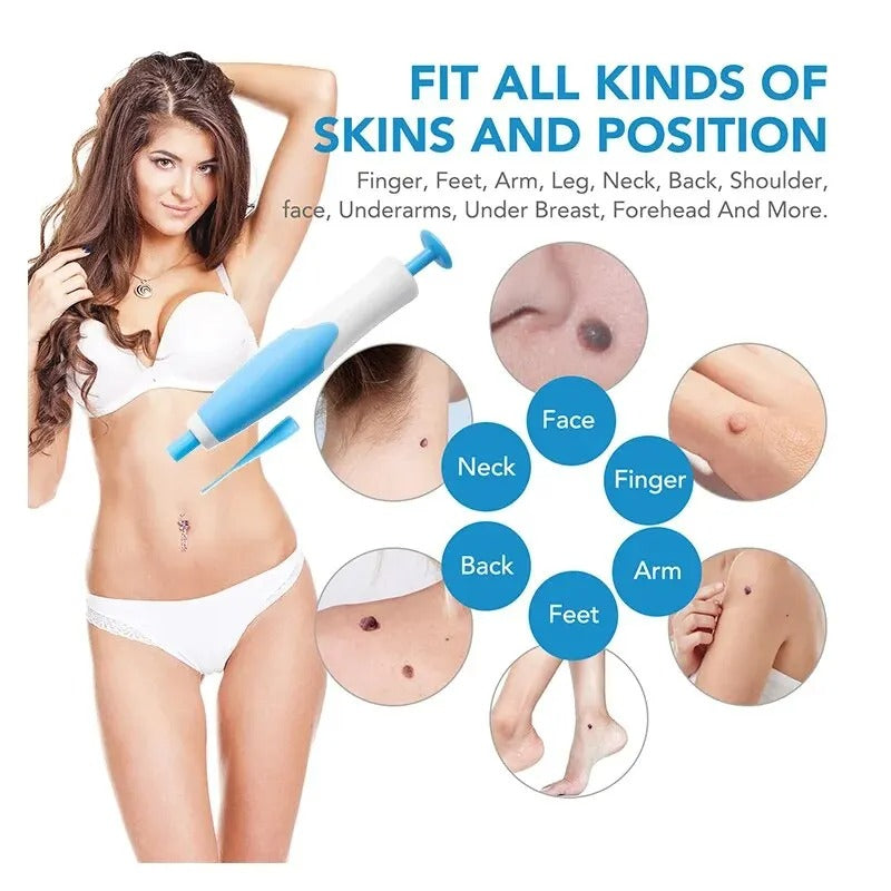 Skin Tag Removal Kit with Dual Heads and 40 Silicone Bands, Cleansing Wipes All Vera Mart