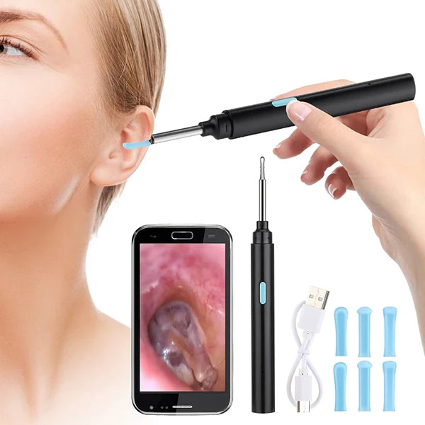 Ear Inspection Camera with 20X Magnification and Wireless App Control All Vera Mart