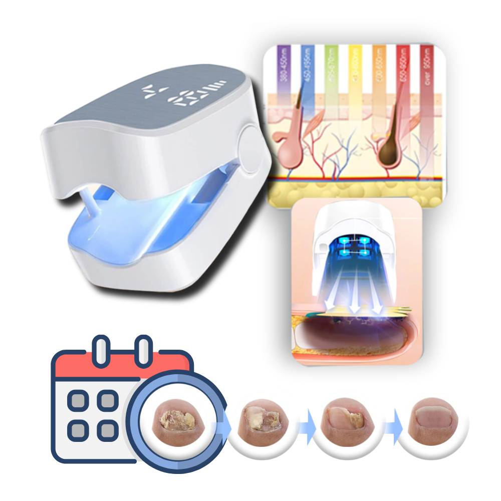 Dual Laser Nail Treatment Device with Blue Light and Finger Clip, 25W Power All Vera Mart