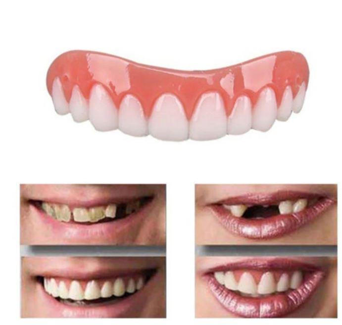 Removable Dental Resin Cover with Gap and Stain Concealment All Vera Mart