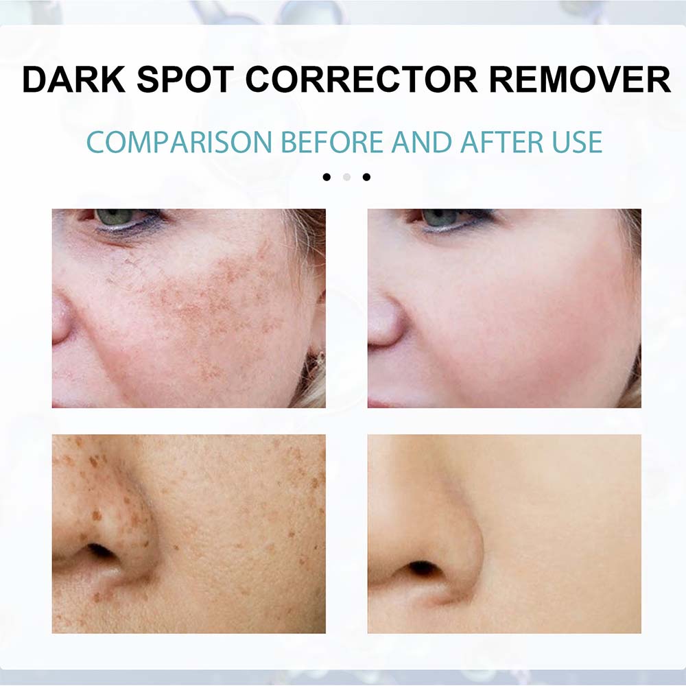 Dark Spot Fading Cream with Nicotinamide and Hydrating Blend for All Skin Types All Vera Mart