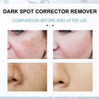 Dark Spot Fading Cream with Nicotinamide and Hydrating Blend for All Skin Types All Vera Mart