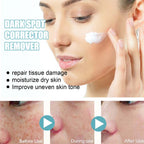 Dark Spot Fading Cream with Nicotinamide and Hydrating Blend for All Skin Types All Vera Mart