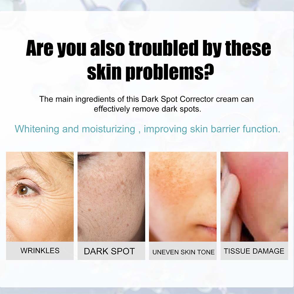 Dark Spot Fading Cream with Nicotinamide and Hydrating Blend for All Skin Types All Vera Mart
