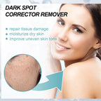 Dark Spot Fading Cream with Nicotinamide and Hydrating Blend for All Skin Types All Vera Mart
