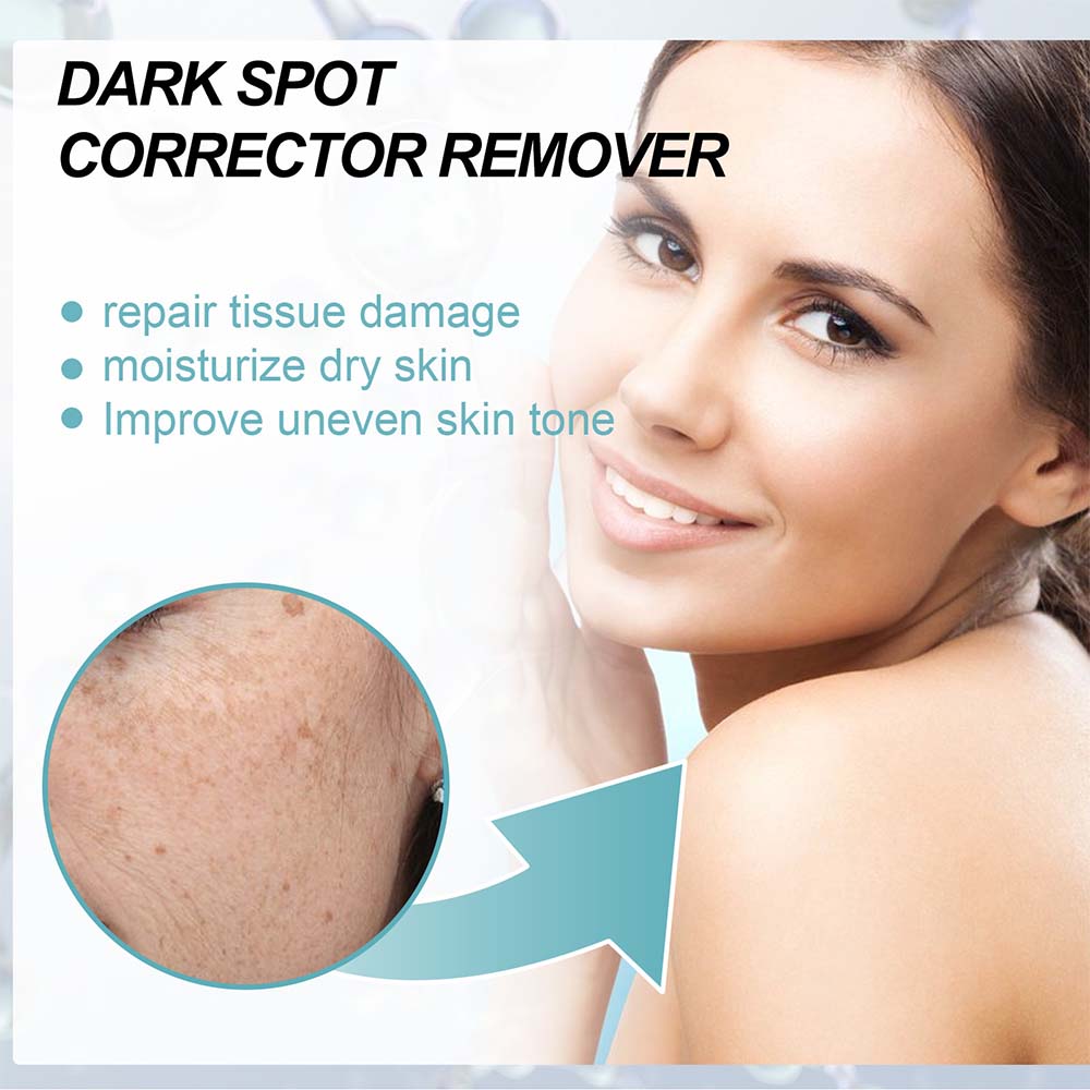 Dark Spot Fading Cream with Nicotinamide and Hydrating Blend for All Skin Types All Vera Mart