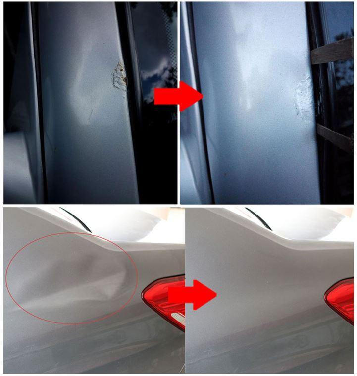 Car Dent Removal Kit with Suction Pads and Pulling Tool, Multiple Sizes All Vera Mart
