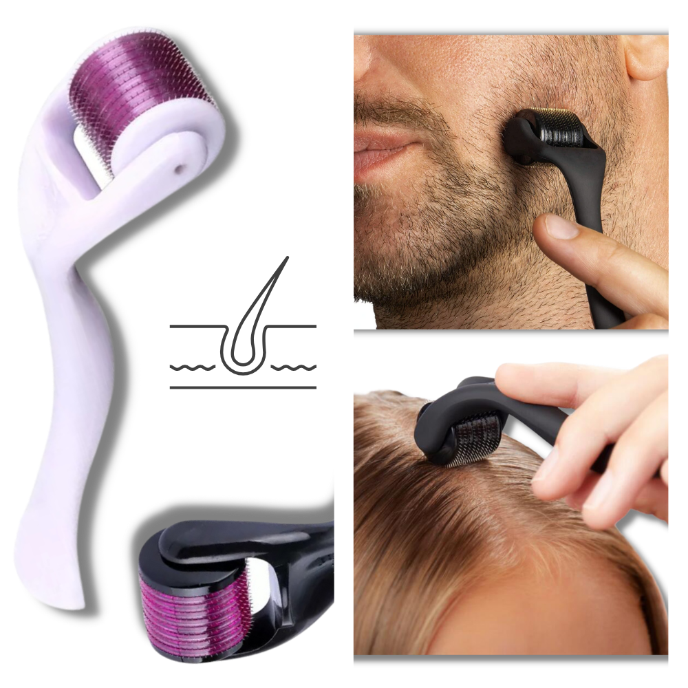 Microneedle Dermal Roller with 540 Stainless Steel Needles and Protective Case All Vera Mart