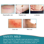 Silicone Scar Removal Sheet with Moisture Barrier and 12-Hour Wear Time All Vera Mart