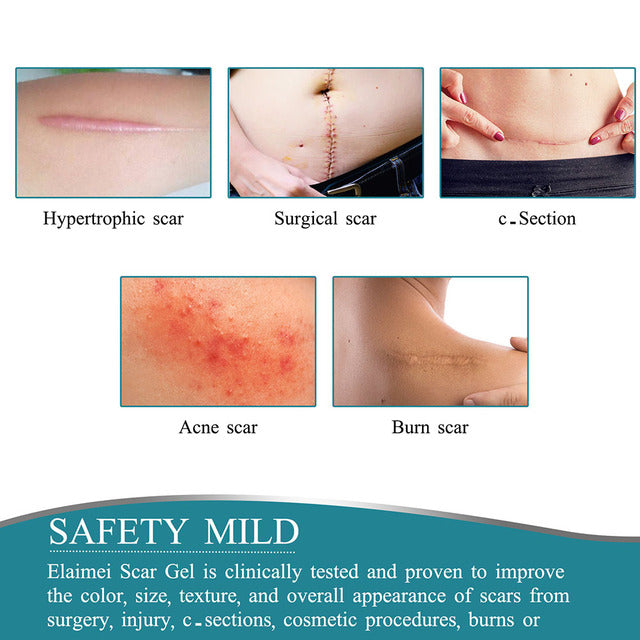 Silicone Scar Removal Sheet with Moisture Barrier and 12-Hour Wear Time All Vera Mart
