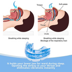 Anti-Snoring Oral Device with Multi-Position Jaw Adjustment and Ergonomic Design All Vera Mart