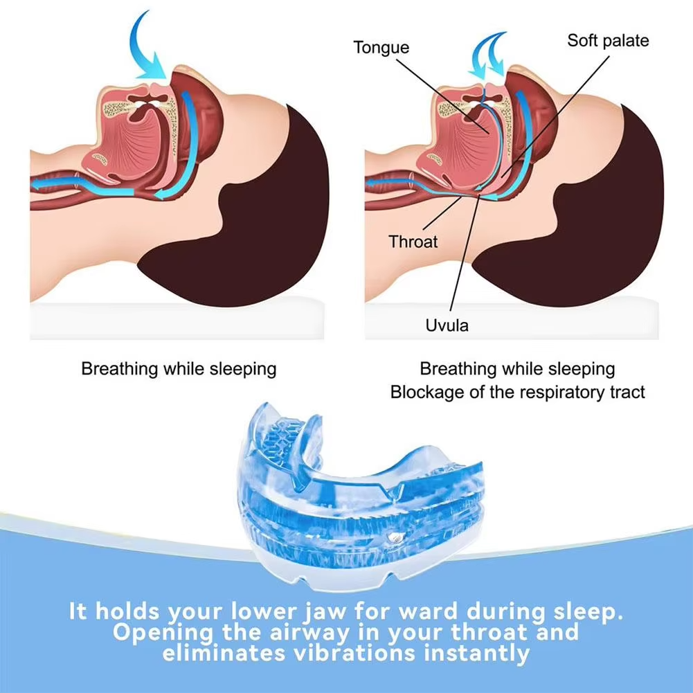 Anti-Snoring Oral Device with Multi-Position Jaw Adjustment and Ergonomic Design All Vera Mart