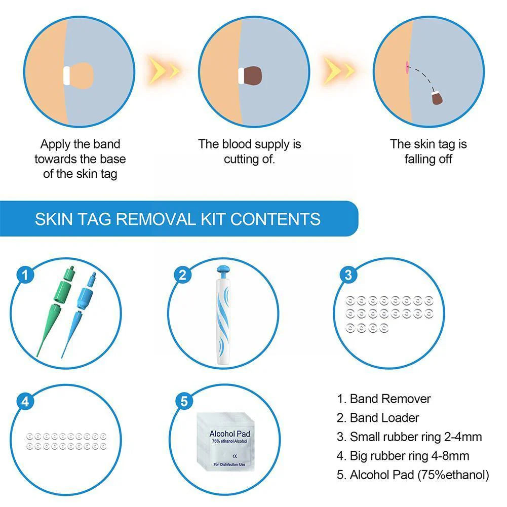 Skin Tag Removal Kit with Two Spring Sizes and Natural Drying Method All Vera Mart