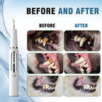 Dog Dental Scaler with LED Light and Negative Ion Technology, Rechargeable All Vera Mart