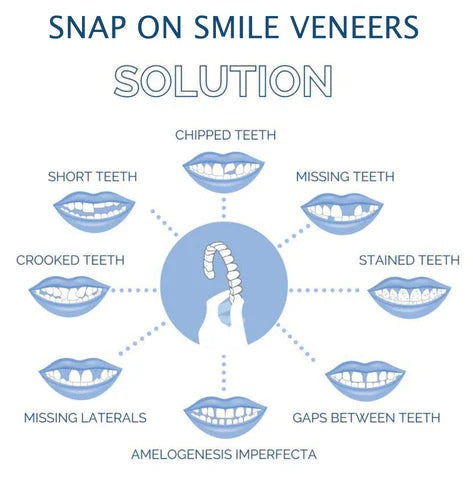 Cosmetic Tooth Cover System with Warm Water Molding and Hand-Clean Design All Vera Mart