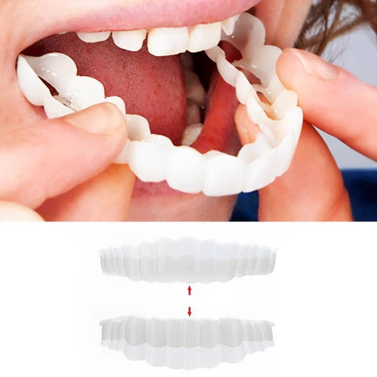 Cosmetic Tooth Cover System with Warm Water Molding and Hand-Clean Design All Vera Mart