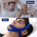 Adjustable Chin Strap with Jaw Support and Nasal Breathing Aid for Sleep All Vera Mart
