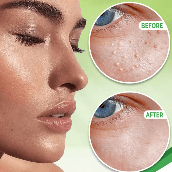 Keratin Reduction Eye Cream with Natural Ingredients for All Skin Types All Vera Mart