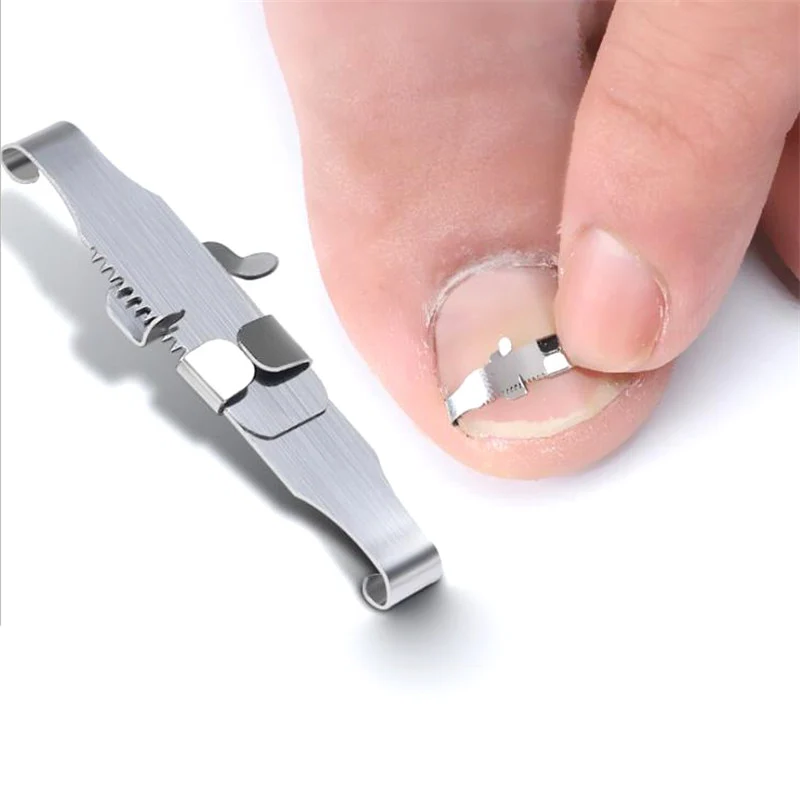 Adjustable Ingrown Toenail Corrector with Stainless Steel Hook and Screw Tension, Three Sizes All Vera Mart
