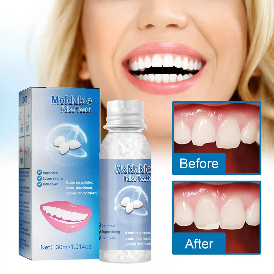 Moldable Tooth Repair Kit with Polymer Beads and Custom Fitting All Vera Mart