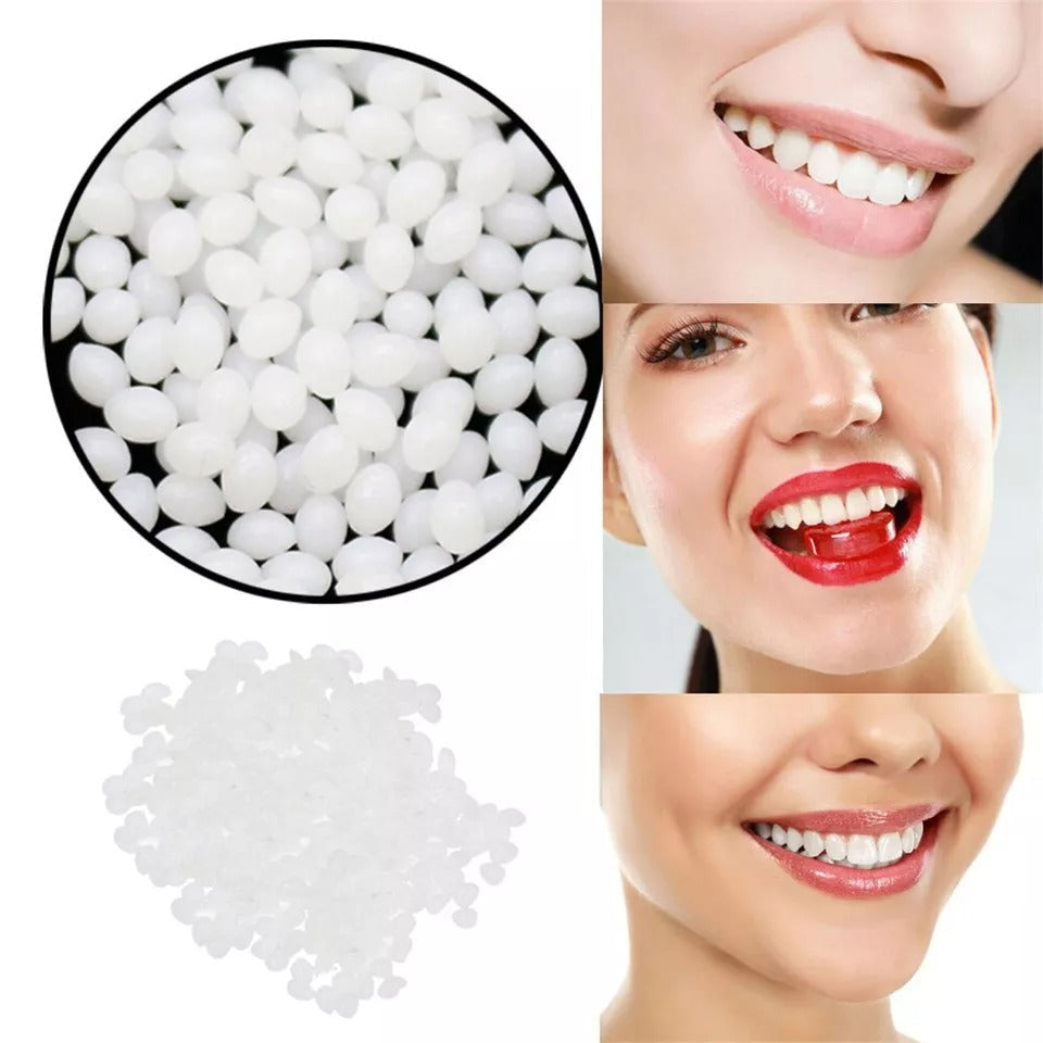 Moldable Tooth Repair Kit with Polymer Beads and Custom Fitting All Vera Mart
